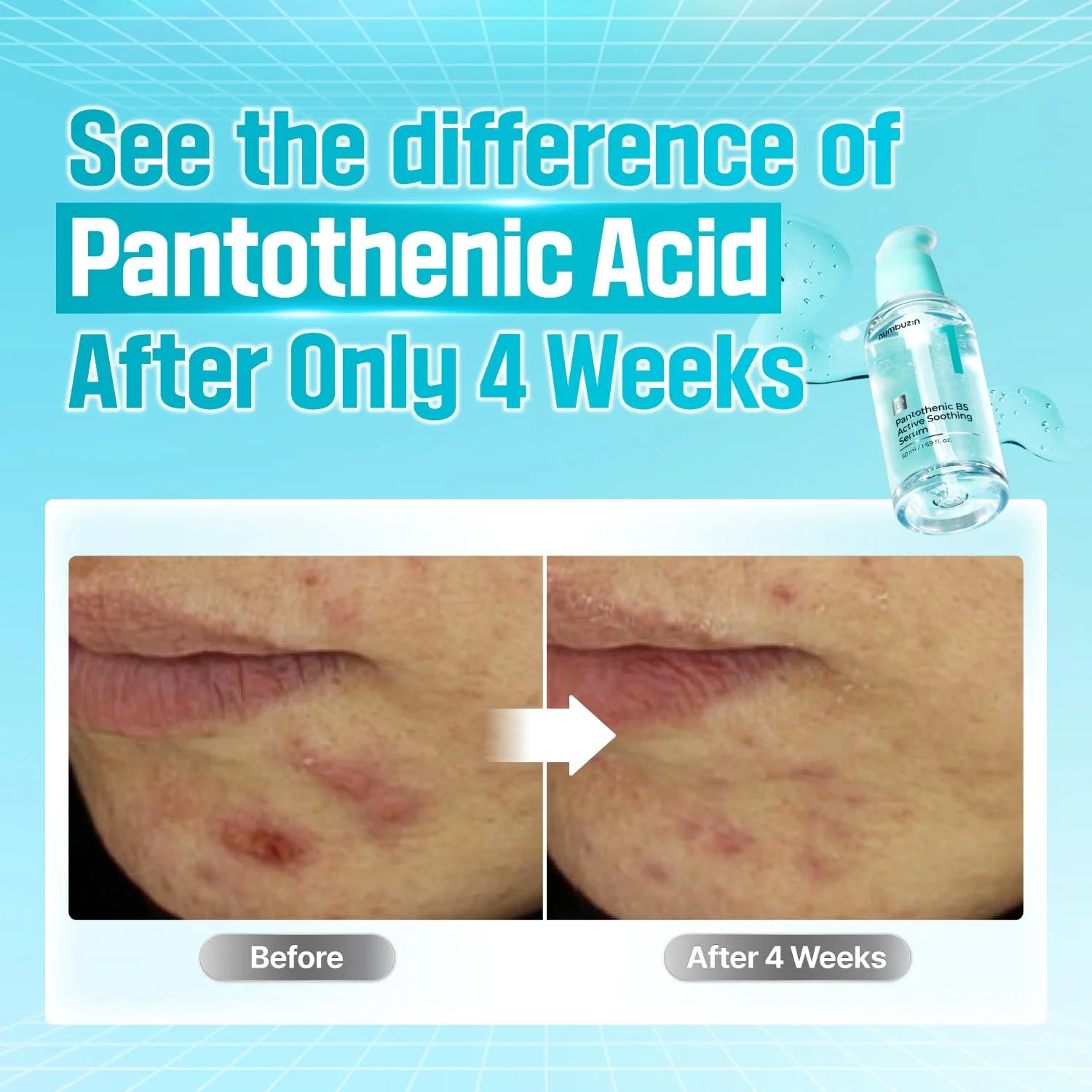 Pantothenic B5 Active Soothing Serum