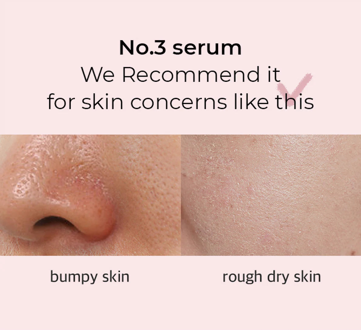 Skin Softening Serum