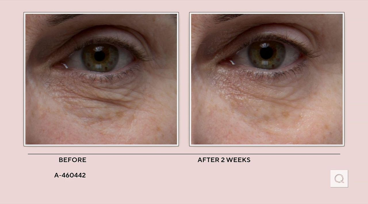 Peptide4 Eye Recovery Cream (15ml)