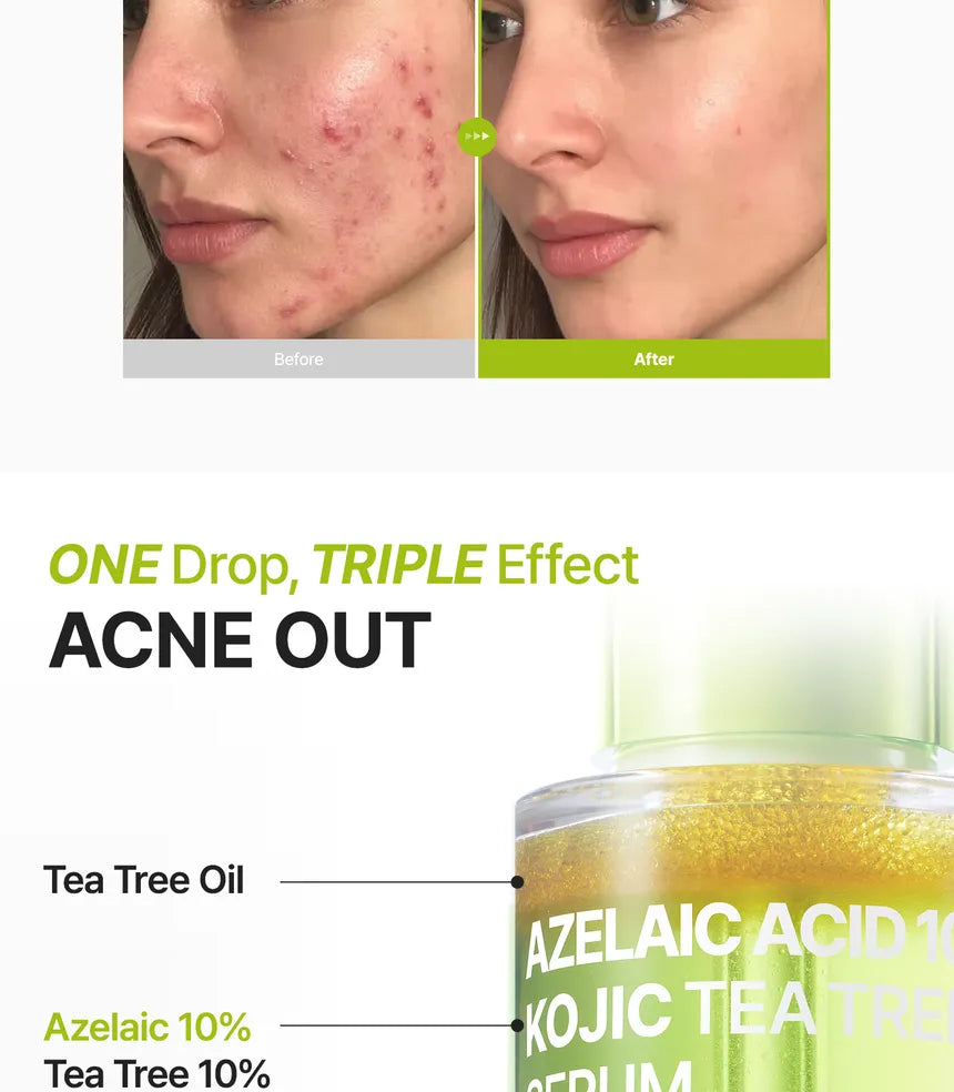 Azelaic Acid 10 Kojic Tea Tree Serum